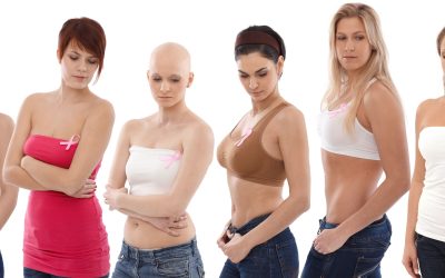 Early Detection and Treatment Options for Colon Cancer Lima Patients in the United States