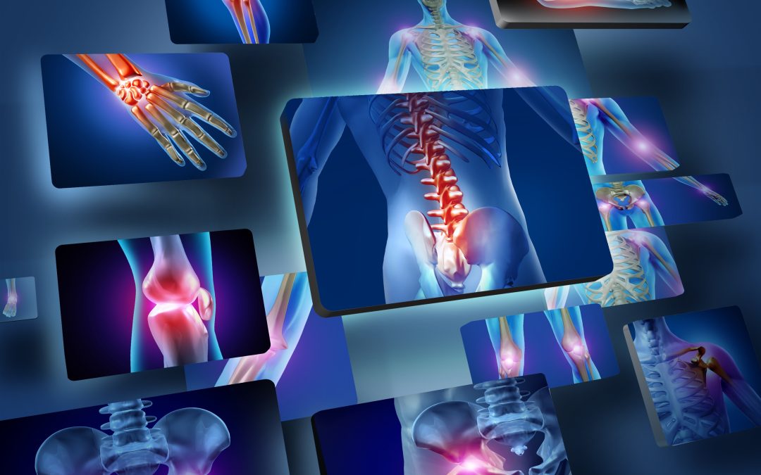 Experience Pain Relief and Improved Mobility With Kyphoplasty in Petersburg, VA