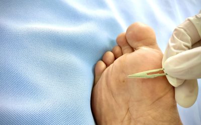 Transform Daily Life Through Heel Pain Treatment in Haymarket VA Solutions