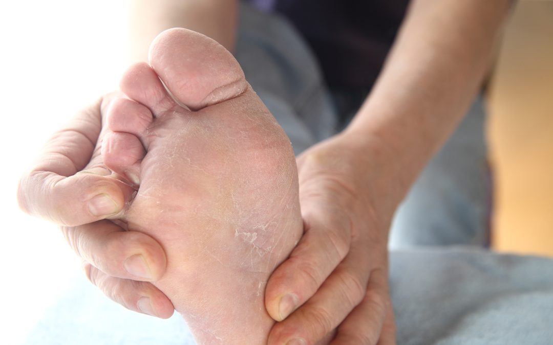 Say Goodbye to Foot Pain with Effective Bunion Treatment in Manassas, VA, Today