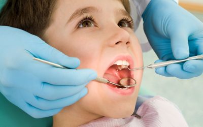 Transform Your Smile With Professional Teeth Whitening Services Loma Linda CA