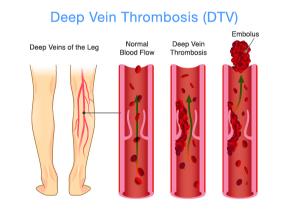Smooth Out Imperfections Using Spider Veins Treatment in Baltimore, MD for Healthier Skin
