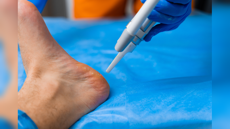 Effective foot pain relief awaits with a trusted Podiatrist, Manalapan, NJ residents rely on